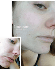 CIT Face Roller PLATINUM