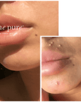 CIT Face Roller PLATINUM