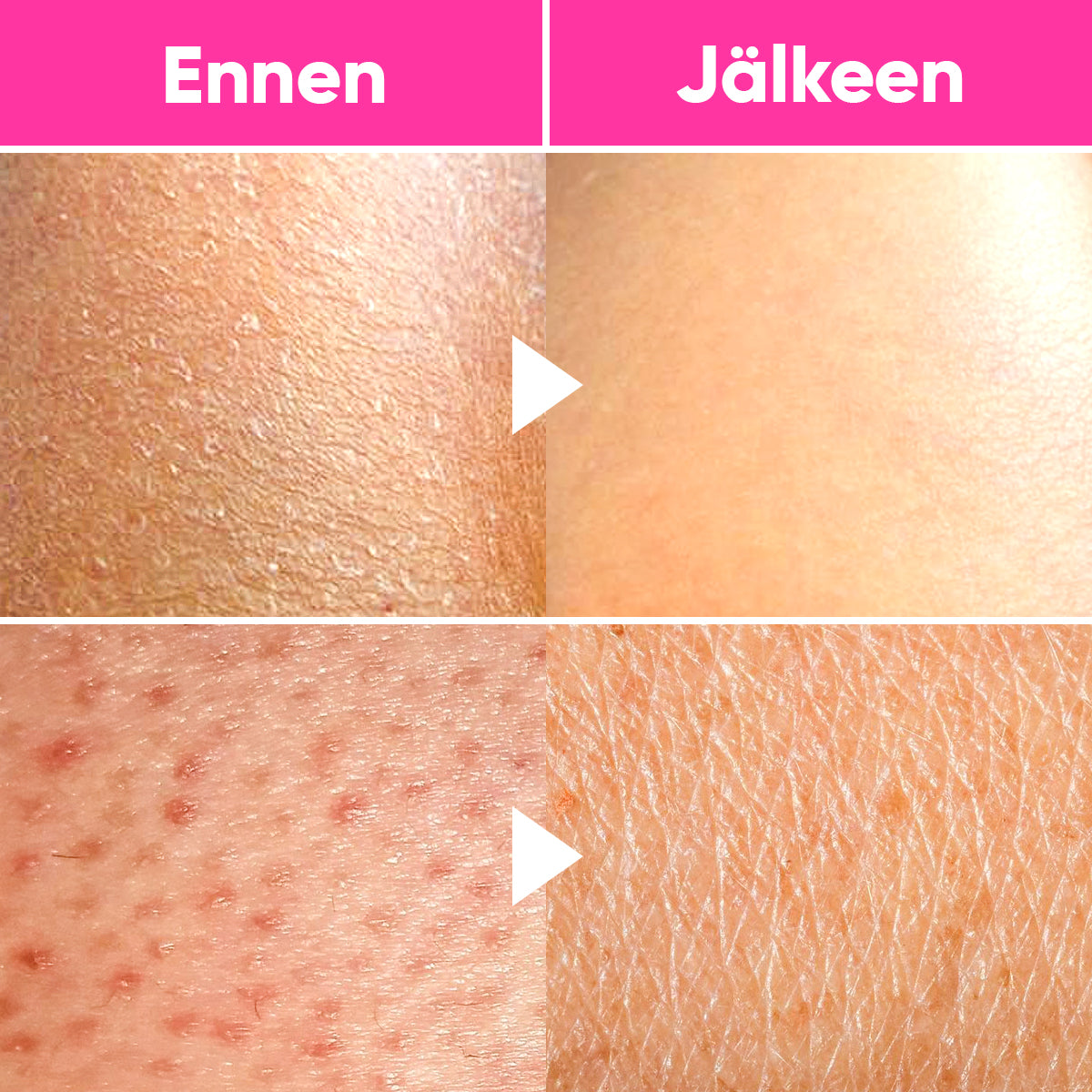 So Silky Mitt™️ | 100 % Silkkiä