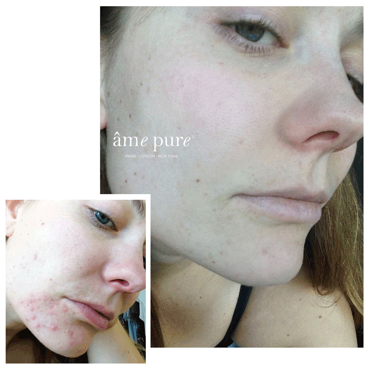 CIT Face Roller PLATINUM